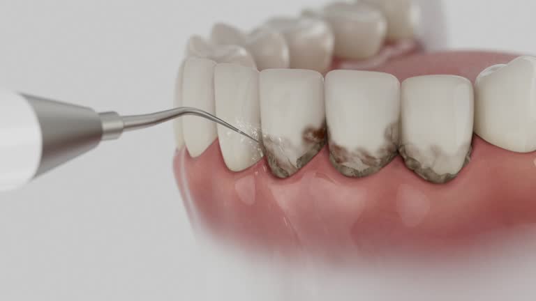 Trusted Teeth Cleaning And Checkup service in Brentwood, MO - Dentist Open Now